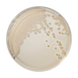 Thermo Scientific&trade;&nbsp;Spectra&trade; Candida Agar